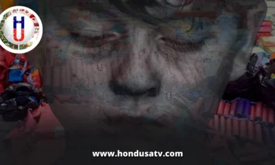 Hasta el momento 18 menores han resultado quemados por pólvora