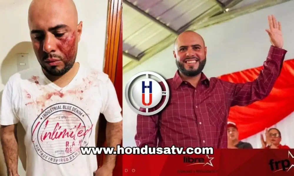 Atentan contra precandidato a alcaldía de Mangulile, Olancho