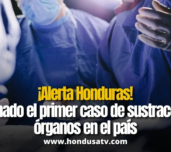 Honduras confirma el primer caso de sustracción de órganos: una mujer descubre que le extrajeron un riñón sin su consentimiento