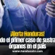 Honduras confirma el primer caso de sustracción de órganos: una mujer descubre que le extrajeron un riñón sin su consentimiento